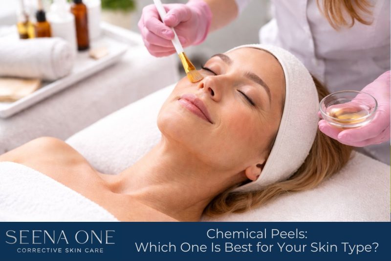 Chemical Peels Which One Is Best for Your Skin Type