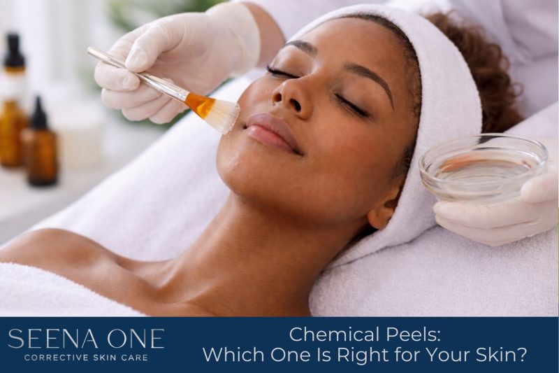 Chemical Peels: Which One Is Right for Your Skin?