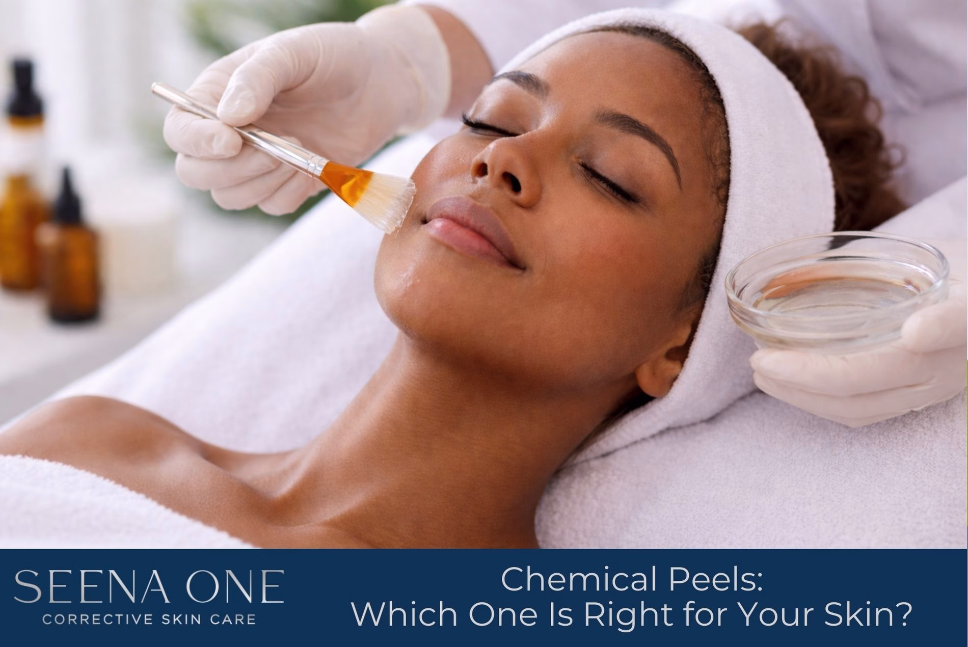 Chemical Peels: Which One Is Right for Your Skin?