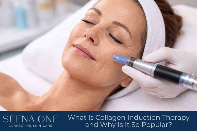 What Is Collagen Induction Therapy and Why Is It So Popular